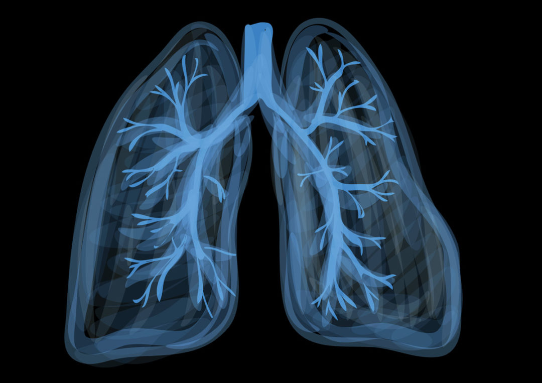 Acupuncture for Asthma